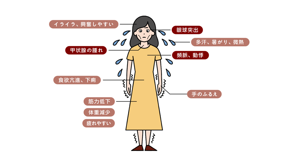 図:バセドウ病の症状