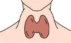 バセドウ病イラスト