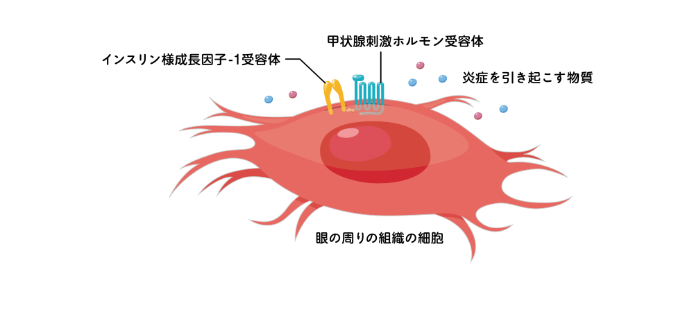 図:眼の周りの組織で炎症が起こるしくみ